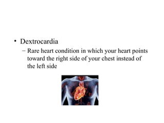 • Dextrocardia
– Rare heart condition in which your heart points
toward the right side of your chest instead of
the left side
 