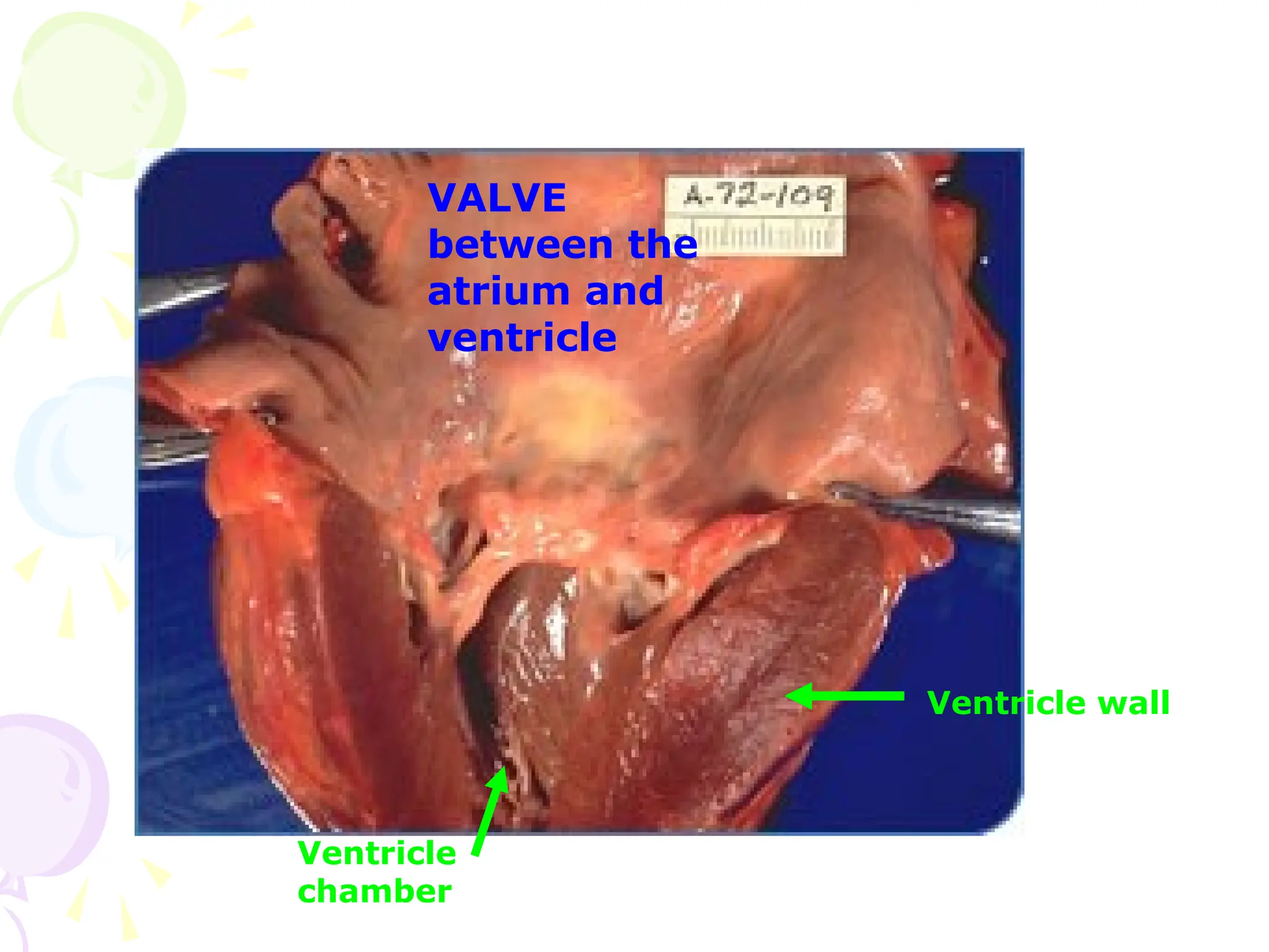 VALVE
between the
atrium and
ventricle
Ventricle wall
Ventricle
chamber
 