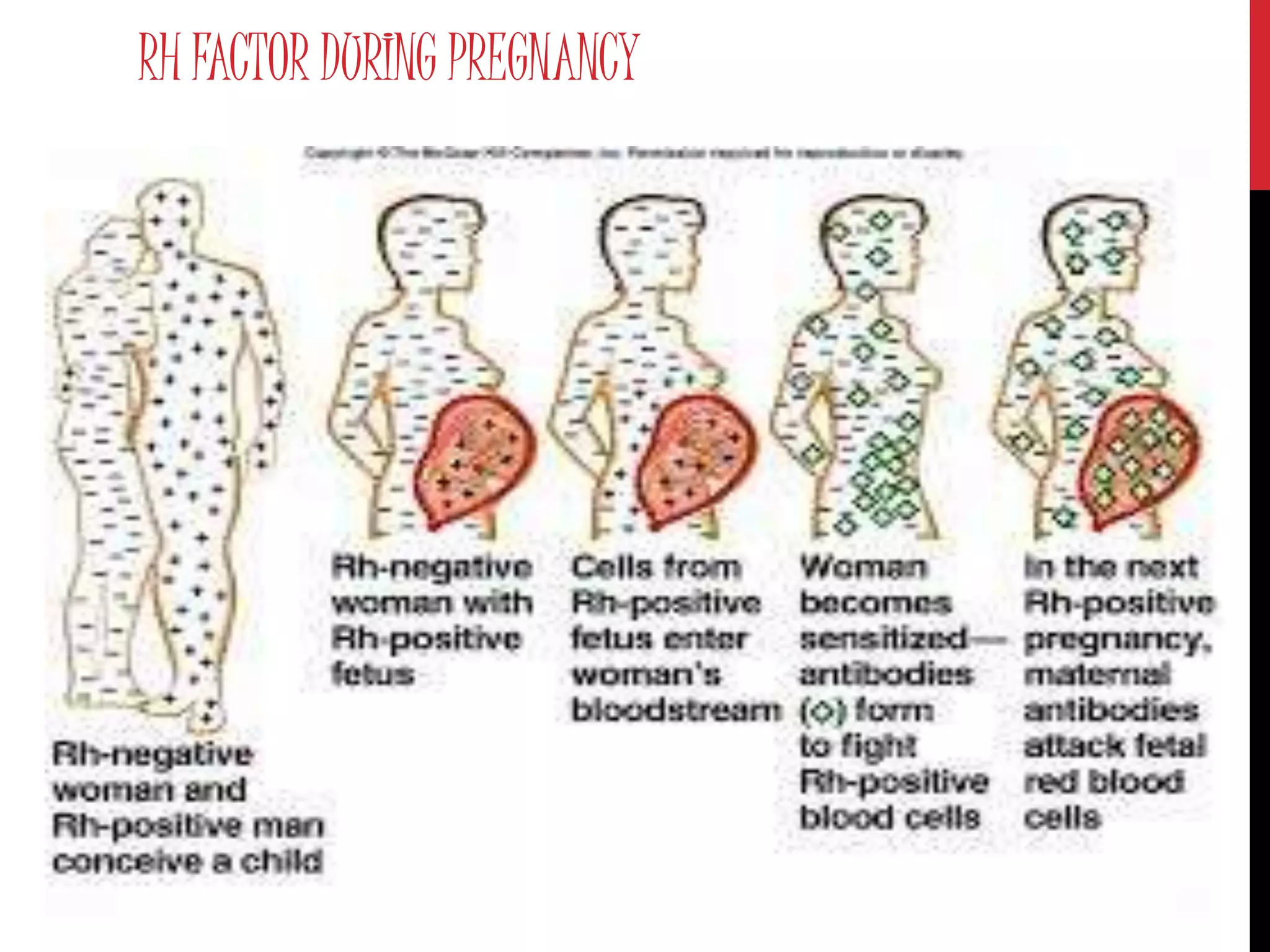 RH FACTOR DURING PREGNANCY
 