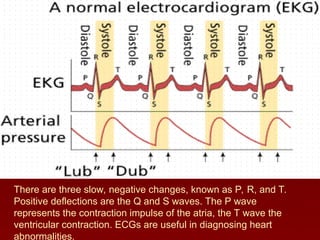 There are three slow, negative changes, known as P, R, and T.
Positive deflections are the Q and S waves. The P wave
represents the contraction impulse of the atria, the T wave the
ventricular contraction. ECGs are useful in diagnosing heart
abnormalities.
 