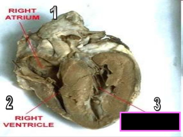 Human Heart Visual Quiz PowerPoint, Parts of the Heart, Chambers, Cir…