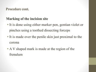 Procedure cont.
Marking of the incision site
 It is done using either marker pen, gentian violet or
pinches using a toothed dissecting forceps
 It is made over the penile skin just proximal to the
corona
 A V shaped mark is made at the region of the
frenulum
 
