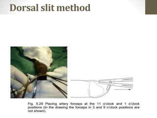 Dorsal slit method
 