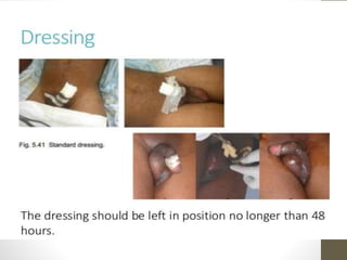 Procedurecont.
Wound dressing
 Clean the incision site with normal saline, apply
suflatulle and then sterile gauze and wrap with co
adhesive bandage
 
