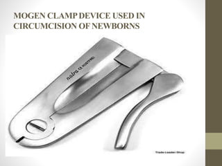 MOGEN CLAMPDEVICE USED IN
CIRCUMCISION OFNEWBORNS
 