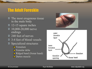 Circumcision | PPT