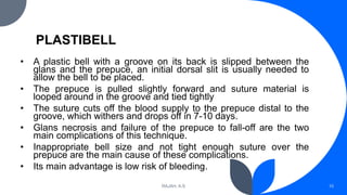 PLASTIBELL
• A plastic bell with a groove on its back is slipped between the
glans and the prepuce, an initial dorsal slit is usually needed to
allow the bell to be placed.
• The prepuce is pulled slightly forward and suture material is
looped around in the groove and tied tightly
• The suture cuts off the blood supply to the prepuce distal to the
groove, which withers and drops off in 7-10 days.
• Glans necrosis and failure of the prepuce to fall-off are the two
main complications of this technique.
• Inappropriate bell size and not tight enough suture over the
prepuce are the main cause of these complications.
• Its main advantage is low risk of bleeding.
RAJAH, A.S 10
 
