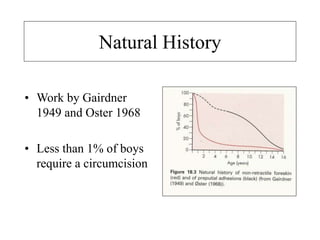 Natural History
• Work by Gairdner
1949 and Oster 1968
• Less than 1% of boys
require a circumcision
 