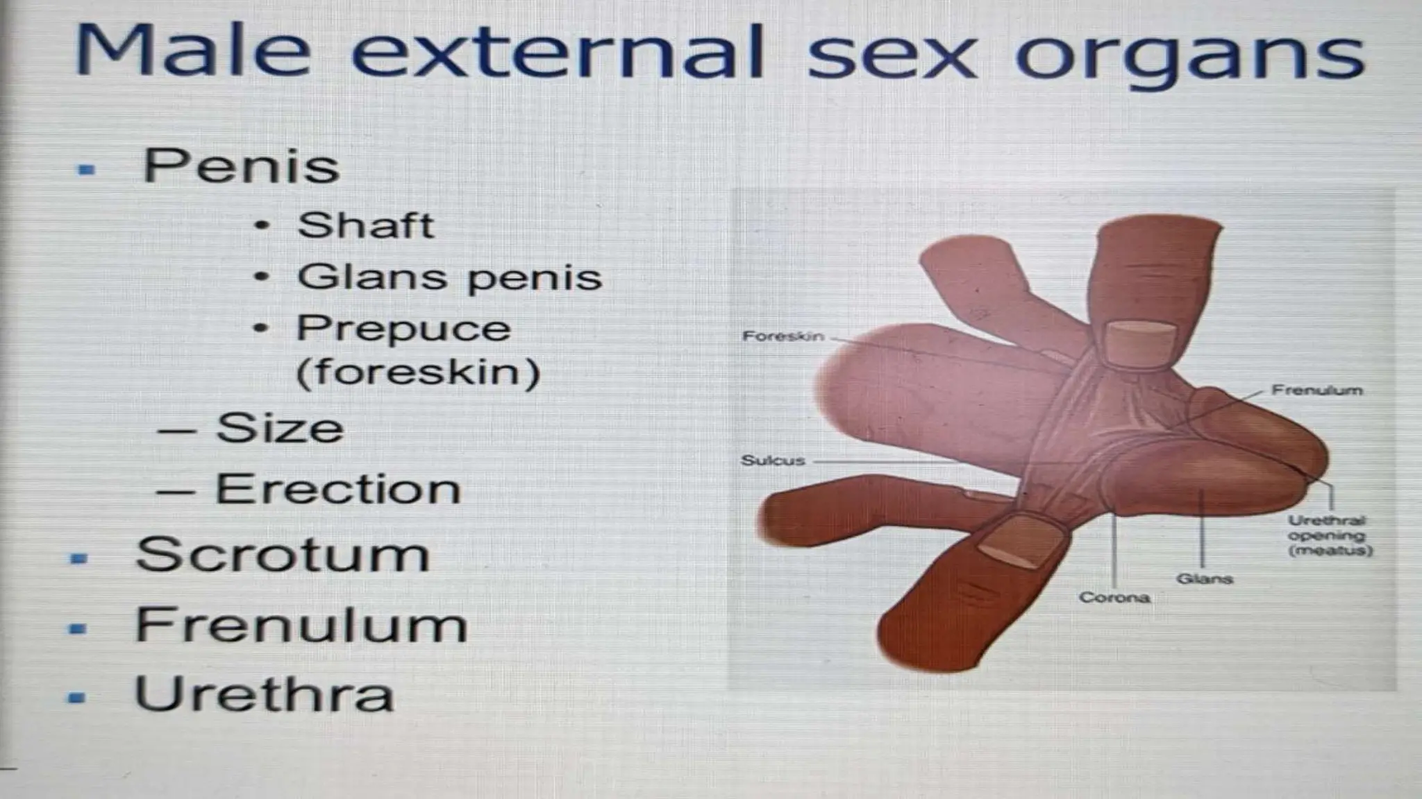 CIRCUMCISION pptx CIRCUMCISION pptx