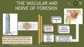 Circumcision Procedure In Hemophilia Patients Revision pptx circumcision-procedure-in-hemophilia-patients-revision-pptx