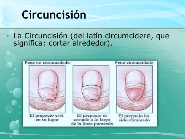 cortar frenillo prepucio circuncisi 243 n cortar frenillo prepucio circuncisi 243 n