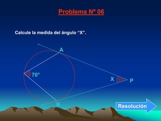 A70°XPBResoluciónProblema Nº 06Calcule la medida del ángulo “X”.