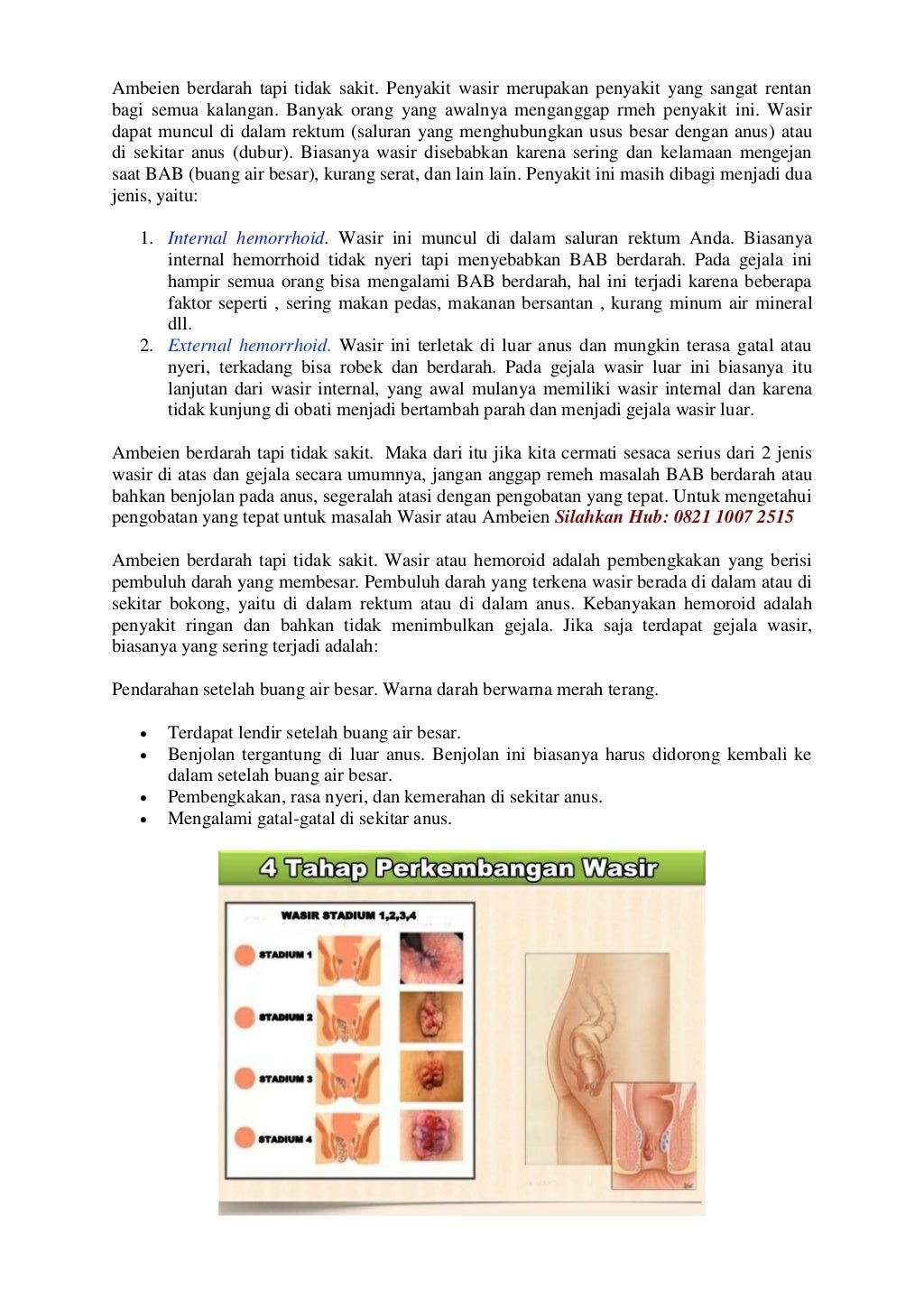 CiriCiri Ambeien Yang Sudah Sembuh