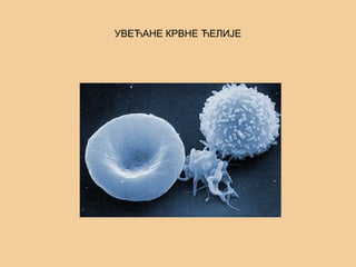 УВЕЋАНЕ КРВНЕ ЋЕЛИЈЕ
 