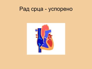 Рад срца - успорено
 