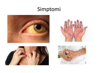 Simptomi
 
