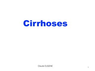 Cirrhoses
Claude EUGENE
1
 