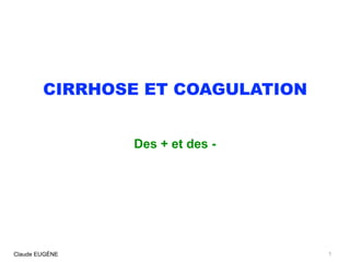 CIRRHOSE ET COAGULATION
Des + et des -
Claude EUGÈNE 1
 
