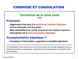 CIRRHOSE ET COAGULATION
Thrombose de la veine porte
(4/6)
Pronostic
- Aggravation liée plus à la sévérité de l’atteinte hé...