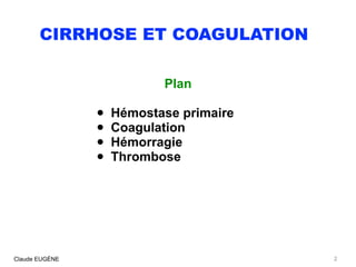CIRRHOSE ET COAGULATION
Plan
• Hémostase primaire
• Coagulation
• Hémorragie
• Thrombose
Claude EUGÈNE 2
 