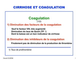 CIRRHOSE ET COAGULATION
Coagulation
(1/2)
1) Diminution des facteurs de la coagulation
Sauf le facteur VIII, très augmenté...