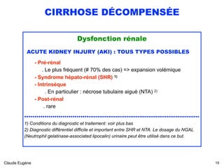 CIRRHOSE DÉCOMPENSÉE
Dysfonction rénale
ACUTE KIDNEY INJURY (AKI) : TOUS TYPES POSSIBLES
- Pré-rénal 
. Le plus fréquent (# 70% des cas) => expansion volémique 
- Syndrome hépato-rénal (SHR) 1) 
- Intrinsèque 
. En particulier : nécrose tubulaire aiguë (NTA) 2) 
- Post-rénal 
. rare
.............................................................................................
1) Conditions du diagnostic et traitement: voir plus bas
2) Diagnostic différentiel difficile et important entre SHR et NTA. Le dosage du NGAL
(Neutrophil gelatinase-associated lipocalin) urinaire peut être utilisé dans ce but.
Claude Eugène !19
 