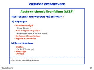 CIRRHOSE DÉCOMPENSÉE
Acute-on-chronic liver failure (ACLF)
RECHERCHER UN FACTEUR PRÉCIPITANT 1) 
a) Hépatique
- Alcoolisation aiguë 
(binge drinking...) 
- Virus à tropisme hépatique 
(Réactivation virale B, virus A, virus E...) 
- Médicament hépatotoxique 
- Hépatite auto-immune 
 
b) Extra-hépatique
- Infection 
(30 à > 50% des cas) 
- Hémorragie 
- Chirurgie
...................................................................................................................
1) Non retrouvé dans 40 à 50% des cas
Claude Eugène !27
 