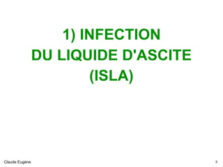 1) INFECTION
DU LIQUIDE D'ASCITE
(ISLA)
Claude Eugène !3
 