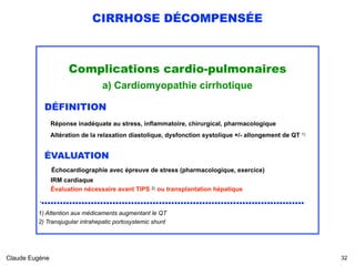 CIRRHOSE DÉCOMPENSÉE
Complications cardio-pulmonaires
a) Cardiomyopathie cirrhotique
DÉFINITION 
Réponse inadéquate au stress, inflammatoire, chirurgical, pharmacologique 
Altération de la relaxation diastolique, dysfonction systolique +/- allongement de QT 1)
ÉVALUATION  
Échocardiographie avec épreuve de stress (pharmacologique, exercice) 
IRM cardiaque 
Évaluation nécessaire avant TIPS 2) ou transplantation hépatique
......................................................................................
1) Attention aux médicaments augmentant le QT
2) Transjugular intrahepatic portosystemic shunt
Claude Eugène !32
 