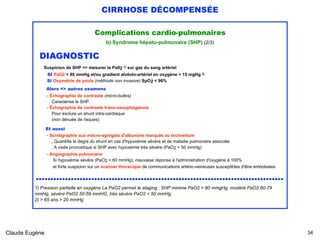 CIRRHOSE DÉCOMPENSÉE
Complications cardio-pulmonaires
b) Syndrome hépato-pulmonaire (SHP) (2/3)
DIAGNOSTIC 
Suspicion de SHP => mesurer la Pa02 1) sur gaz du sang artériel 
SI PaO2 < 80 mmHg et/ou gradient alvéolo-artériel en oxygène > 15 mgHg 2)  
Si Oxymétrie de pouls (méthode non invasive) SpO2 < 96%
Alors => autres examens
 
- Échographie de contraste (micro-bulles) 
Caractérise le SHP 
- Échographie de contraste trans-oesophagienne 
Pour exclure un shunt intra-cardiaque 
(non dénuée de risques)
Et aussi
- Scintigraphie aux macro-agrégats d'albumine marqués au technetium 
. Quantifie le degré du shunt en cas d'hypoxémie sévère et de maladie pulmonaire associée 
. A visée pronostique si SHP avec hypoxémie très sévère (PaO2 < 50 mmHg) 
- Angiographie pulmonaire
Si hypoxémie sévère (PaO2 < 60 mmHg), mauvaise réponse à l'administration d'oxygène à 100% 
et forte suspicion sur un scanner thoracique de communications artério-veineuses susceptibles d'être embolisées
..................................................................................... 
1) Pression partielle en oxygène La PaO2 permet le staging : SHP minime PaO2 > 80 mmgHg, modéré PaO2 60-79
mmHg, sévère PaO2 50-59 mmHG, très sévère PaO2 < 50 mmHg.
2) > 65 ans > 20 mmHg
Claude Eugène !34
 
