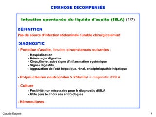 CIRRHOSE DÉCOMPENSÉE
Infection spontanée du liquide d'ascite (ISLA) (1/7)
DÉFINITION
Pas de source d'infection abdominale curable chirurgicalement
DIAGNOSTIC
- Ponction d'ascite, lors des circonstances suivantes :
 
- Hospitalisation 
- Hémorragie digestive 
- Choc, fièvre, autre signe d'inflammation systémique
- Signes digestifs 
- Aggravation de l'état hépatique, rénal, encéphalopathie hépatique
- Polynucléaires neutrophiles > 250/mm3 = diagnostic d'ISLA
- Culture
- Positivité non nécessaire pour le diagnostic d'ISLA 
- Utile pour le choix des antibiotiques
- Hémocultures
Claude Eugène !4
 