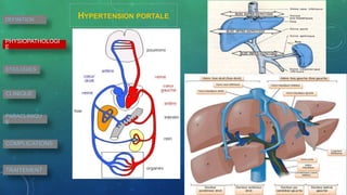 • HYPERTSENSION PORTALE • INSUFFISANCEHEPATO CELLULAIRE
DEFINITION
PHYSIOPATHOLOGI
E
ETIOLOGIES
CLINIQUE
PARACLINIQU
E
COMPLICATIONS
TRAITEMENT
HYPERTENSION PORTALE
 