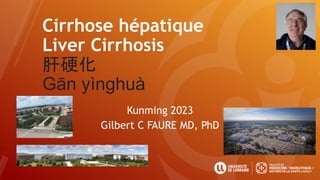 Cirrhose hépatique
Liver Cirrhosis
肝硬化
Gān yìnghuà
Kunming 2023
Gilbert C FAURE MD, PhD
 