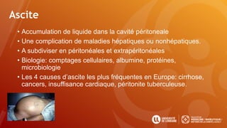 Ascite
• Accumulation de liquide dans la cavité péritoneale
• Une complication de maladies hépatiques ou nonhépatiques.
• A subdiviser en péritonéales et extrapéritonéales
• Biologie: comptages cellulaires, albumine, protéines,
microbiologie
• Les 4 causes d’ascite les plus fréquentes en Europe: cirrhose,
cancers, insuffisance cardiaque, péritonite tuberculeuse.
 