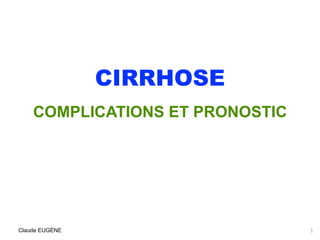CIRRHOSE
COMPLICATIONS ET PRONOSTIC
.
Claude EUGÈNE 1
 