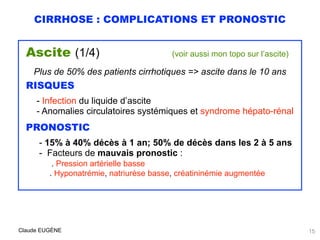 CIRRHOSE : COMPLICATIONS ET PRONOSTIC
Ascite (1/4) (voir aussi mon topo sur l’ascite)
Plus de 50% des patients cirrhotique...