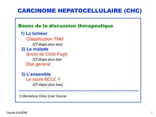 CARCINOME HEPATOCELLULAIRE (CHC)
Bases de la discussion thérapeutique
1) La tumeur 
Classification TNM 
(Cf diapo plus bas...