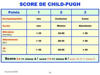 SCORE DE CHILD-PUGH
39
Points 1 2 3
Encéphalopathie non Confusion Coma
Ascite non Minime Abondante
Bilirubine
(mcmol/L)
< 35 35-50 > 50
Albuminémie
(g/L)
> 35 28-35 < 28
TP
(%)
> 50 40-50 < 40
Score 5-6 => classe A / score 7-9 => classe B / score 10-15 => classe C 
Claude EUGENE
 