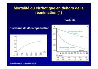 Mortalité du cirrhotique en dehors de la
réanimation (1)
Survenue de décompensation
mortalité
D’Amico et al. J Hepatol 2006
 