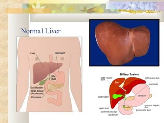 Normal Liver
 