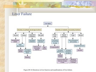 Liver Failure
 