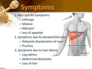 Symptoms 
1. Non specific symptoms- 
– Lethargy 
– Malaise 
– Abd pain 
– loss of appetite 
2. Symptoms due to elevated bilirubin- 
– Yellowish discoloration of eyes 
– Pruritus 
3. Symptoms due to liver failure- 
– Leg edema 
– Abdominal distension 
– Loss of hair 
 