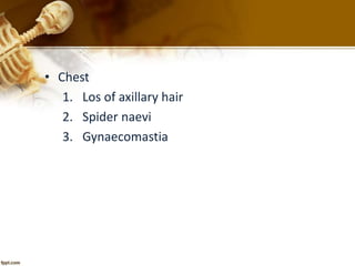 • Chest 
1. Los of axillary hair 
2. Spider naevi 
3. Gynaecomastia 
 
