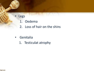 • Legs 
1. Oedema 
2. Loss of hair on the shins 
• Genitalia 
1. Testiculat atrophy 
 