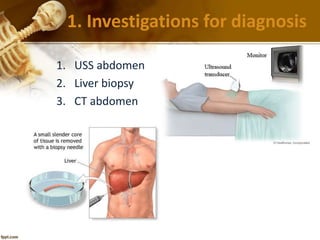 1. Investigations for diagnosis 
1. USS abdomen 
2. Liver biopsy 
3. CT abdomen 
 