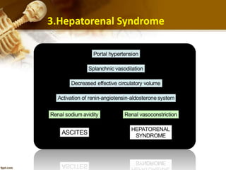 3.Hepatorenal Syndrome 
 