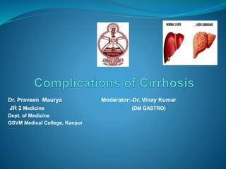 Dr. Praveen Maurya Moderator:-Dr. Vinay Kumar
JR 2 Medicine (DM GASTRO)
Dept. of Medicine
GSVM Medical College, Kanpur
 