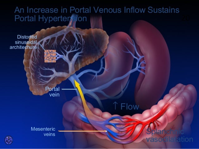 Cirrhosis of liver