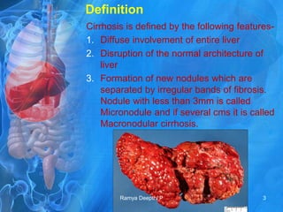Cirrhosis of liver | PPT
