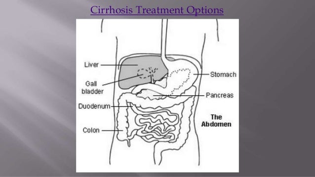 What are some treatment options for cirrhosis?
